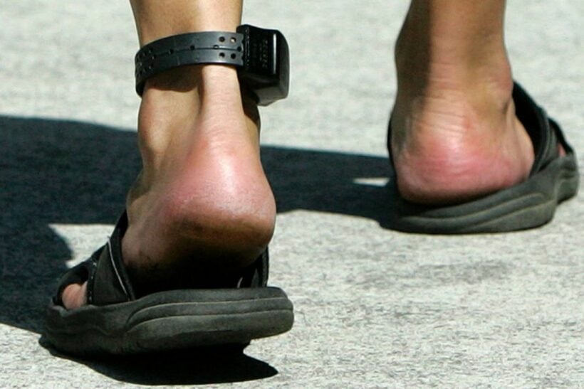 Ministry probes rented electronic monitoring ankle bracelets from China