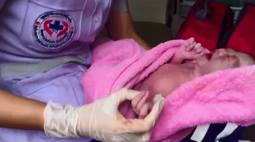 Baby in a rush in Chon Buri, born with 12 fingers and 12 toes