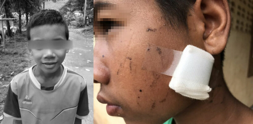 ตำรวจเร่งล่ามือกระสุนปริศนา ยิงเด็กชาย 10 ขวบทะลุขมับกลางศาลา-เจ็บอีก 1 | The Thaiger