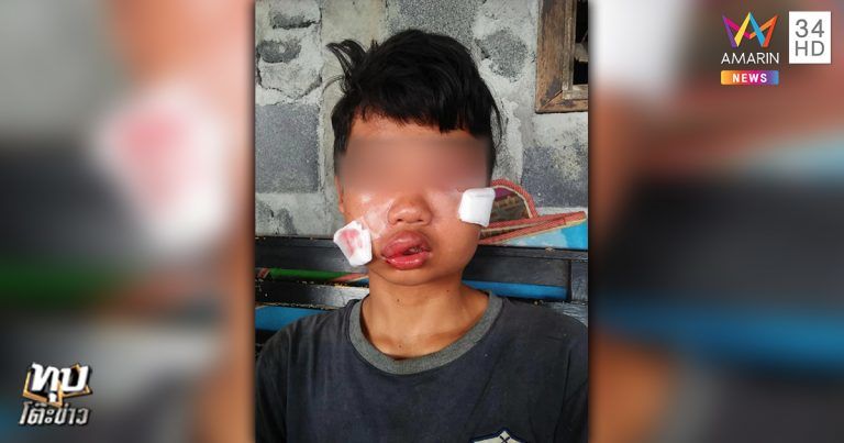 เด็กหนุ่ม 15 ถูกรุมกระทืบหน้าค่ายมวย เจ้าของค่ายมวยบอก กล้องวงจรปิดถอดออกไปแล้ว | The Thaiger