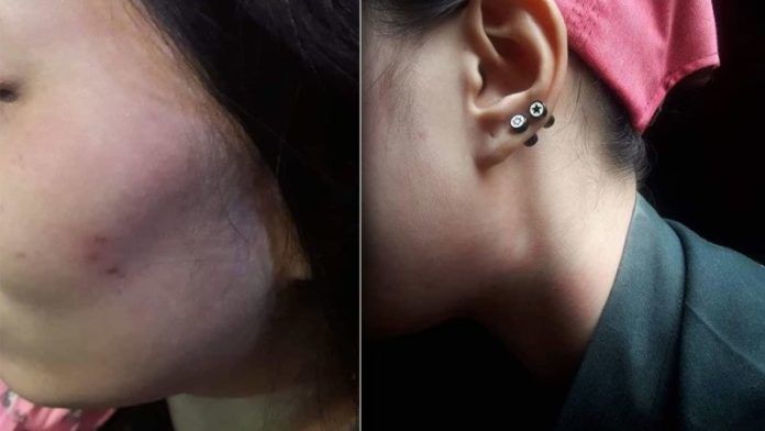 สาวโดนหัวหน้างานลวมลาม ไม่ยอมก็โดนทำร้าย แต่บริษัทลงโทษแค่ตักเตือน | The Thaiger