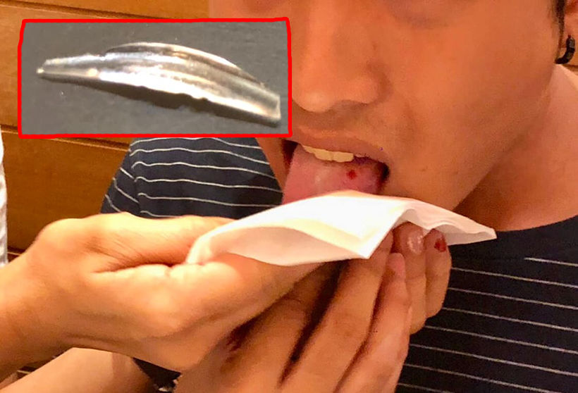 กินข้าวกลางห้างดัง เศษแก้วในอาหารแทงปาก กลืนถึงตาย | The Thaiger