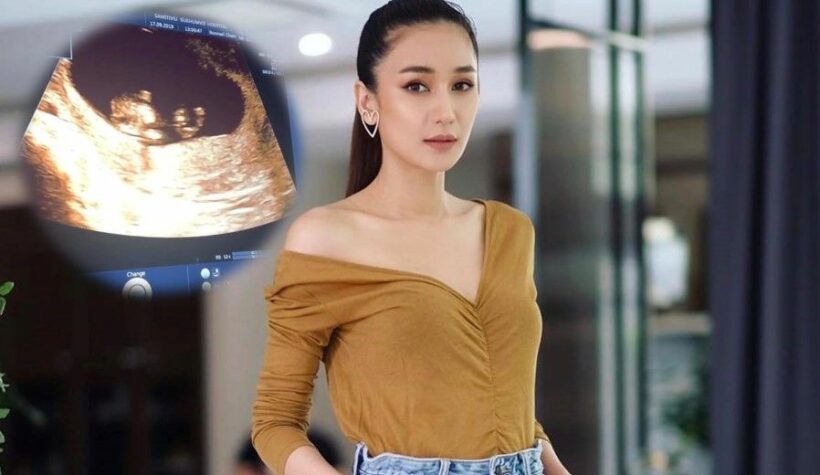 ข่าวดี เนย โชติกาท้องลูกคนที่ 2 แล้ว | The Thaiger