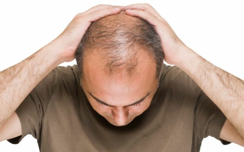 Hair loss. Is there a real solution?