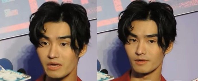 เต๋อ รัฐนันท์ เครียดทำจมูกใหม่ คนชอบหน้าเก่ามากกว่า | The Thaiger
