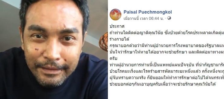 ไพศาล ให้ช่วยติดต่อ เมฆ วินัย พบหมอกัญชาอาจรักษาตุ่มน้ำพองได้ | The Thaiger