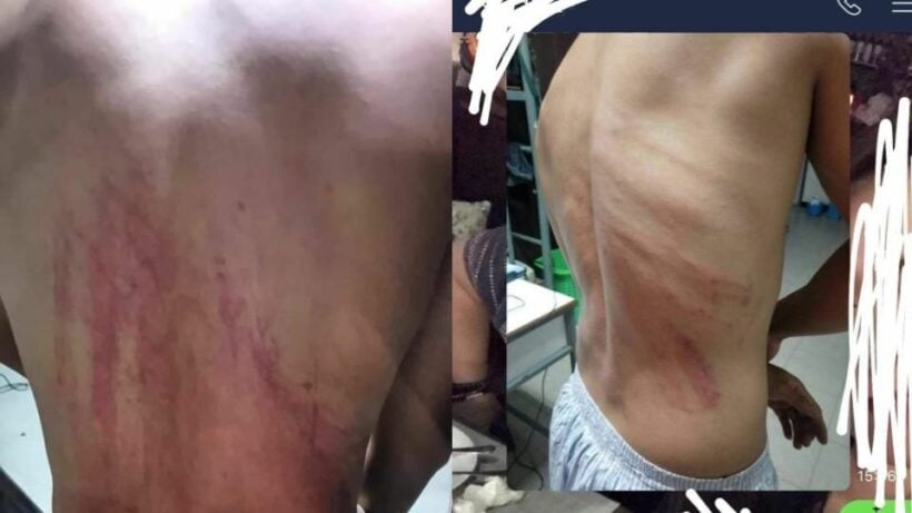 Chiang Mai Police forced into investigating hazing incident at University