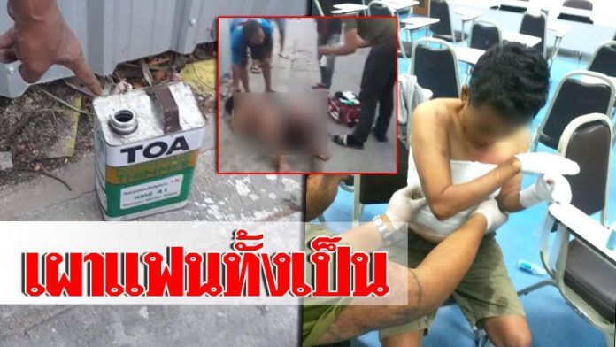 ทอมราดทินเนอร์-จุดไฟเผาแฟนทั้งเป็น บาดเจ็บสาหัส | The Thaiger