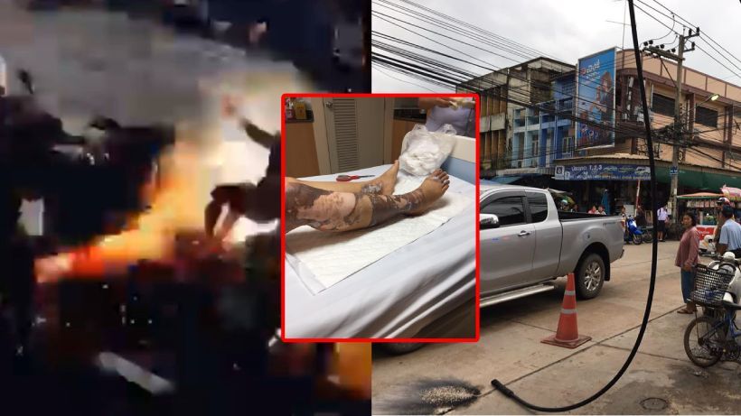 ร้องเรียน แฟนสาวถูกสายไฟแรงสูงตกใส่ ค่ารักษาเหยียบล้าน ไร้การเยียวยา | The Thaiger