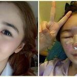 New Bangkok clinic dedicated to fixing surgery gone wrong | Thaiger