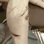 75 year old tourist &#8216;attacked&#8217; by small unidentified shark in Phang Nga | Thaiger