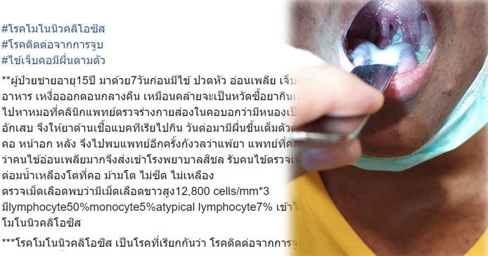 ชายวัย 15 ติดเชื้อไวรัส พบเป็นโรคติดต่อจากการจูบ | The Thaiger
