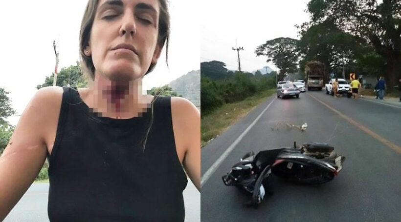 Two tourists hurt as neck-high cable sweeps them off their motorcycle