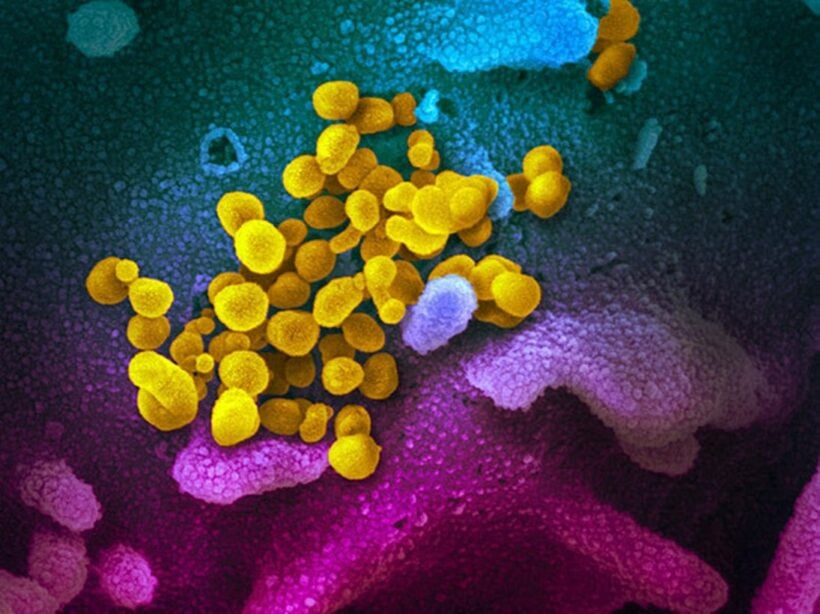 COVID-19: Nga giải mã thành công bộ gene virus corona (SARS-CoV-2)