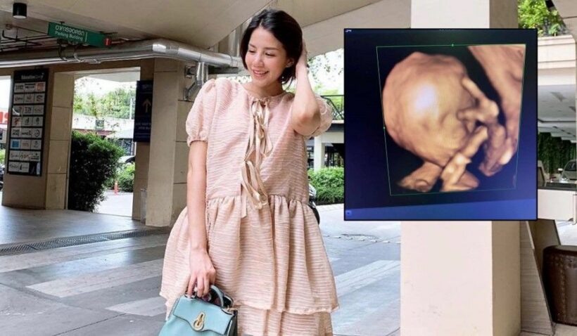 ใบเตย เผยภาพอัลตร้าซาวด์ น้องเวทมนต์ จมูกโด่งแต่ไกล | The Thaiger