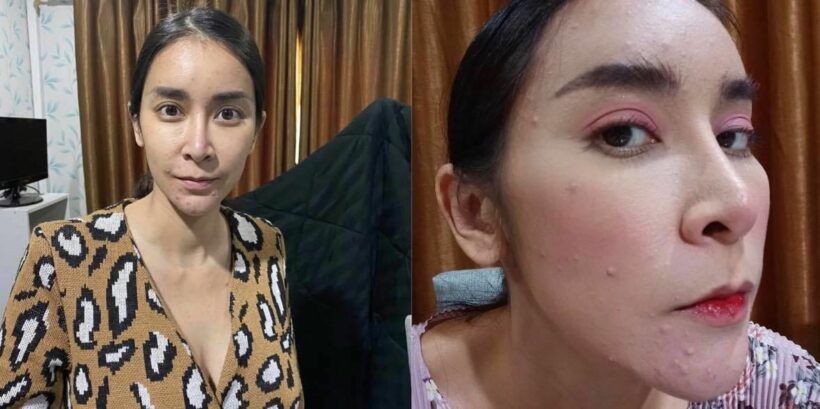 ใหม่ สุคนธวา แพ้ท้องหนัก! หน้าพัง ผมร่วง ยอมไม่สวยเพื่อลูก | The Thaiger