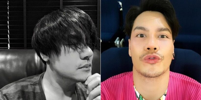 อ๊อฟ ปองศักดิ์ ทำจมูกใหม่ โด่งได้รูป | The Thaiger