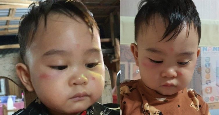 อีฟ พุทธธิดา โกรธ! ลูกชายถูกยุงกัดจนหน้าบวม | The Thaiger
