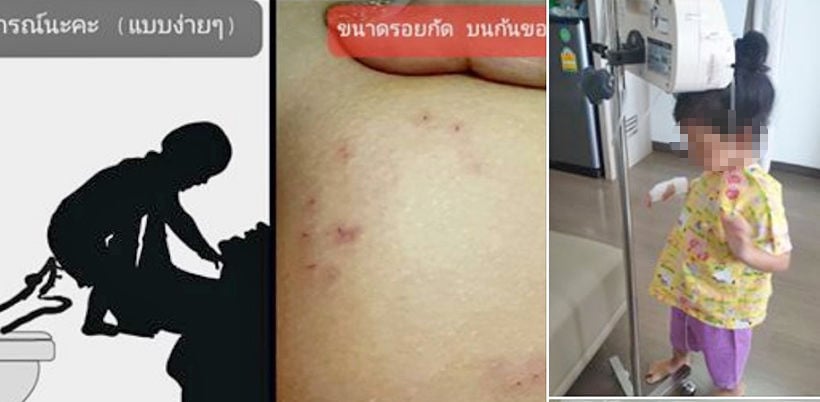 Snake bites Bangkok 4 year old using toilet