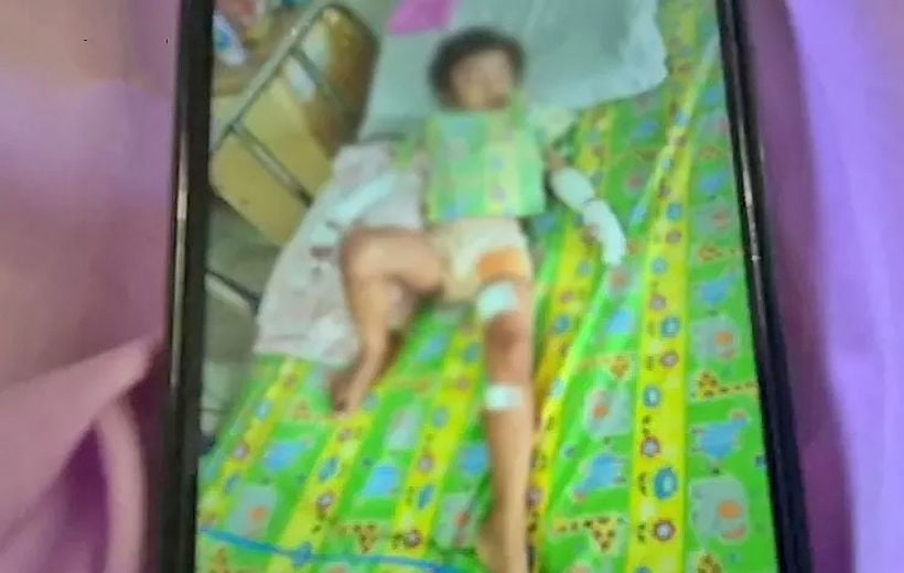 Toddler, playing with hand gel, set alight by brother | News by The Thaiger