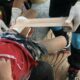 Krabi beach stray dogs attack 4 year old boy | The Thaiger