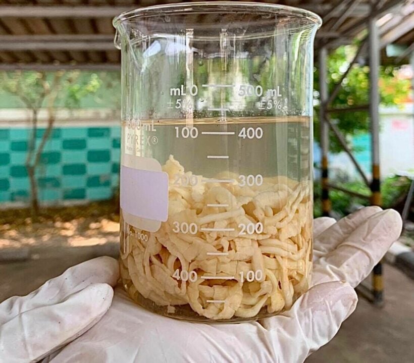 tapeworm segments in human stool