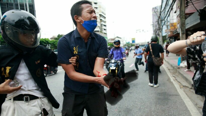 Bangkok Protester that had hand injured from firecracker tests positive for Covid