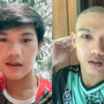 19 year old claims Sinovac vaccine caused his hair to fall out | Thaiger