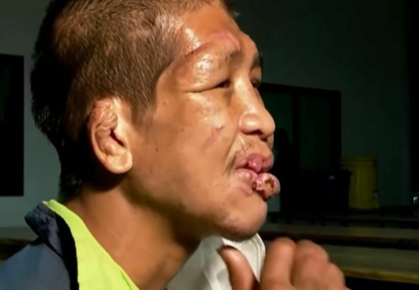 Wounded man flees to police station, says employer beat him, forced him to drink urine