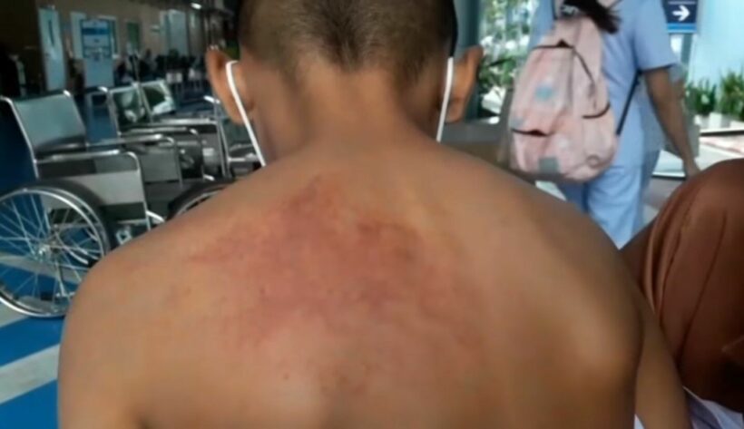 Mother files complaint with Pattaya police after son gets hit, bruised by teacher