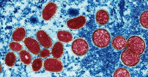 The WHO insist monkeypox is not “a gay disease’