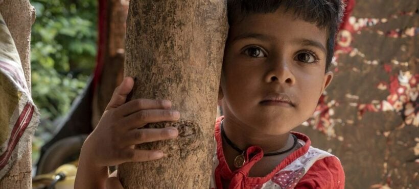 Sri Lanka’s children face malnutrition