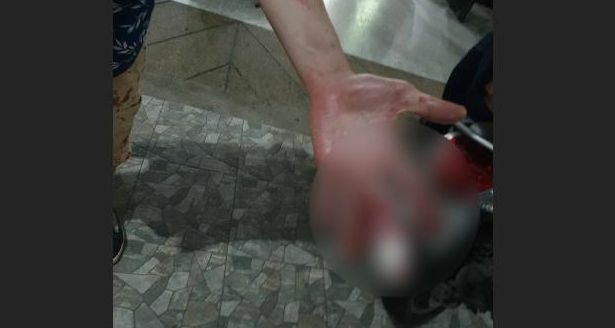 American tourist allegedly assaulted outside Patong bar