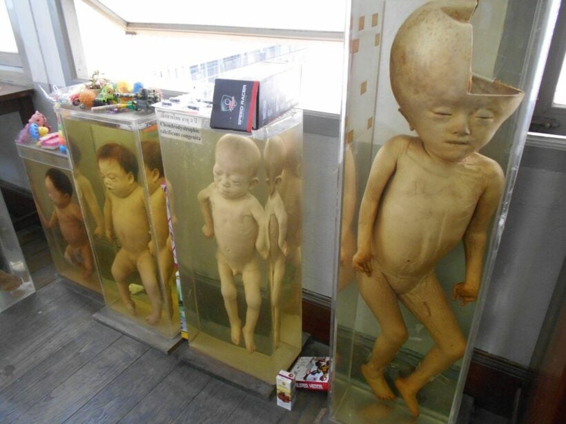 Bangkok's most famous gruesome museum | News by Thaiger