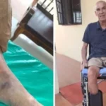 Mosquito bite in Thailand causes Dutchman to lose both legs | Thaiger