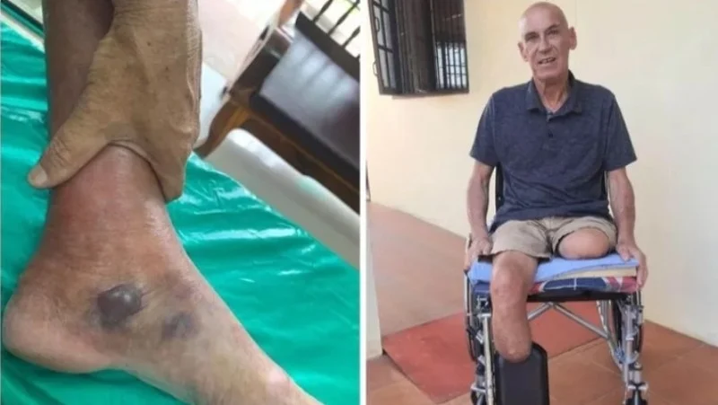 Mosquito bite in Thailand causes Dutchman to lose both legs