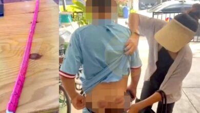 Teacher’s physical punishment causes bruises, outrage