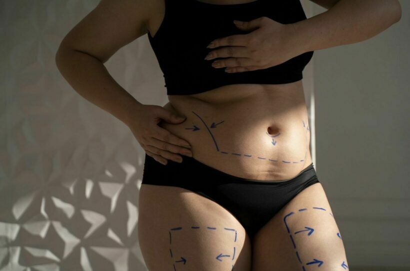 What you need to know about Liposuction in Bangkok, Thailand