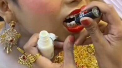 ‘Don’t whiten teeth with nail polish’ Thai medical technologist warns