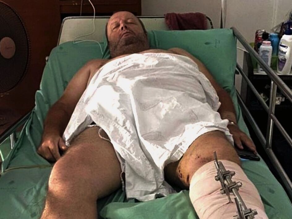 Phuket expat’s urgent appeal for funds after hit-and-run incident