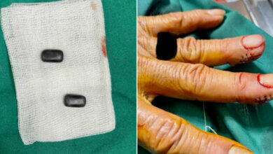 Thai man implants magnets into his fingers for 40 years to win at Hi-Lo