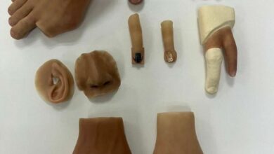 Life-changing silicone prosthetics: The SNMRI is transforming lives