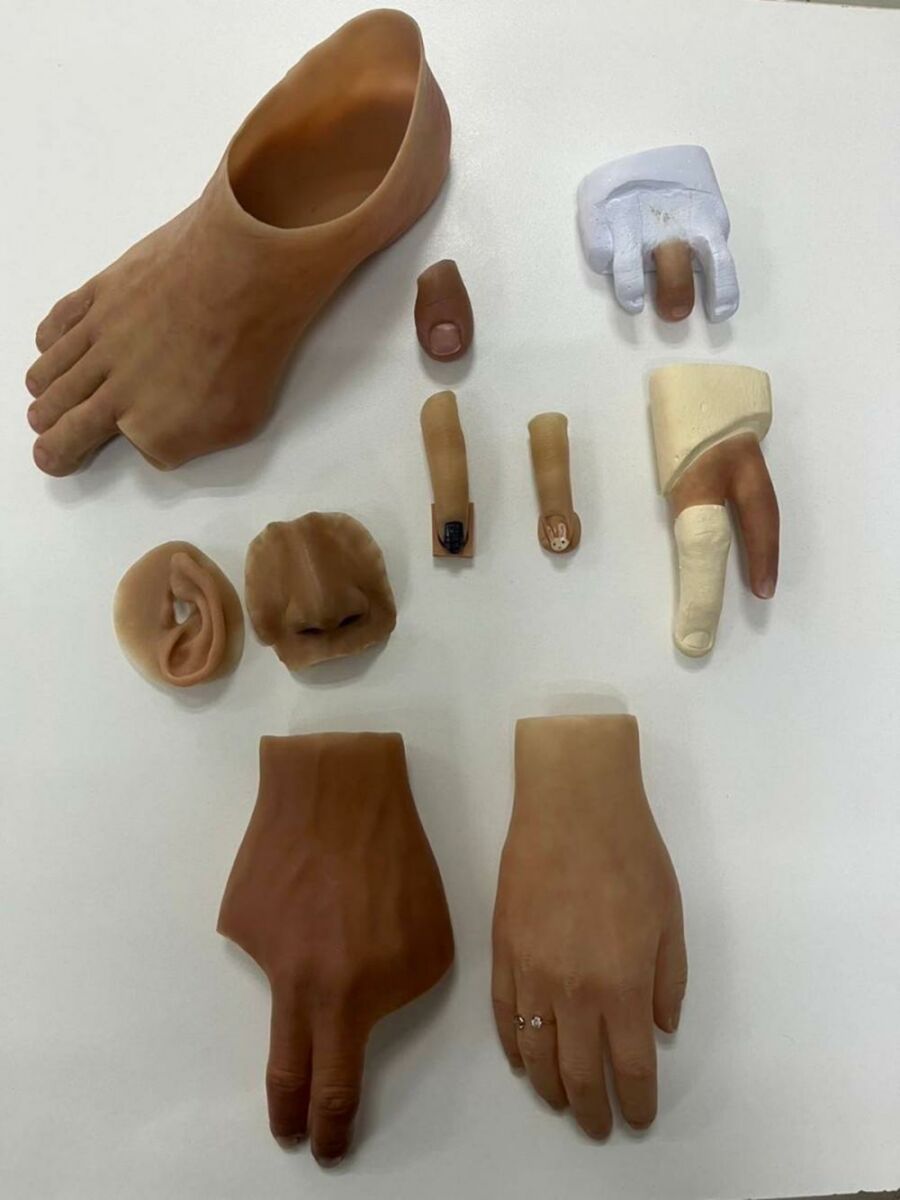 Life-changing silicone prosthetics: The SNMRI is transforming lives