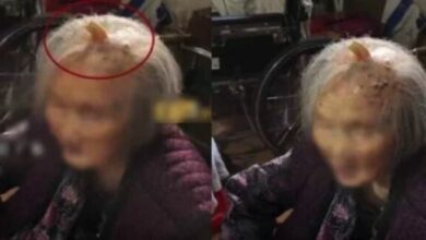 Elderly woman with horn-like growth on head sparks debate about ‘longevity symbol’