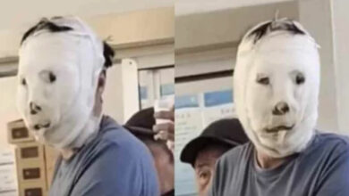 Chinese man leaves ER in pain, but onlookers can’t help laughing at his bandaged face