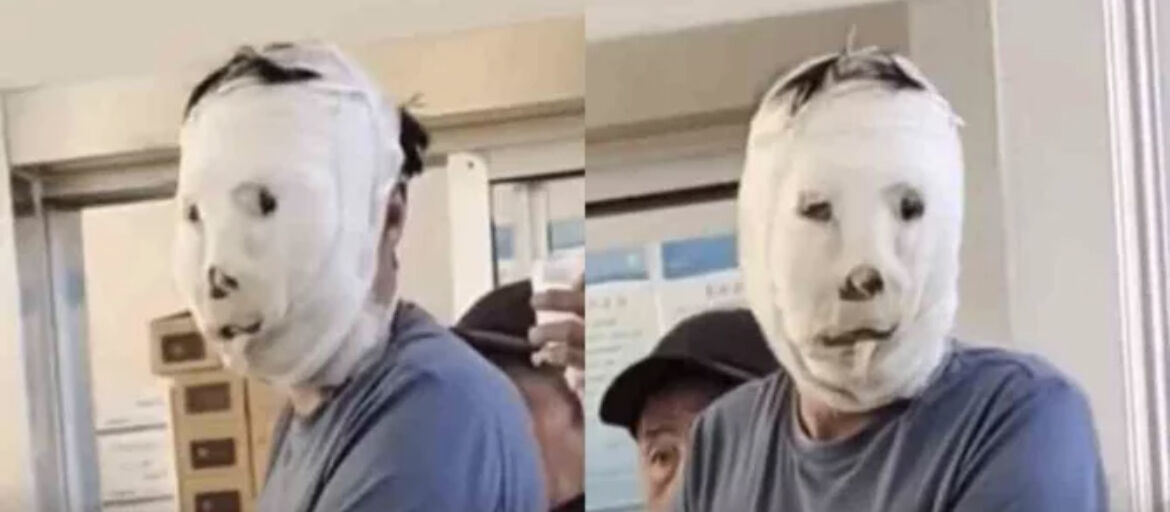 Chinese man leaves ER in pain, but onlookers can’t help laughing at his bandaged face