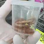 Pregnant woman vomits 10-15cm roundworms, warns on undercooked food risks | Thaiger