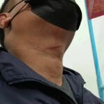 Police attacked while investigating voter fraud, former MP involved | Thaiger