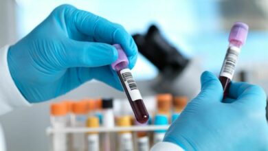 NHS trial shows promise in blood test detecting 50+ cancer types
