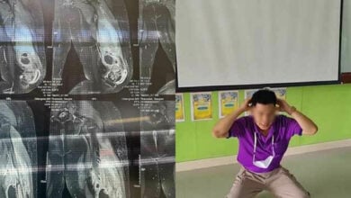Thai school clarifies student’s punishment leading to leg injury